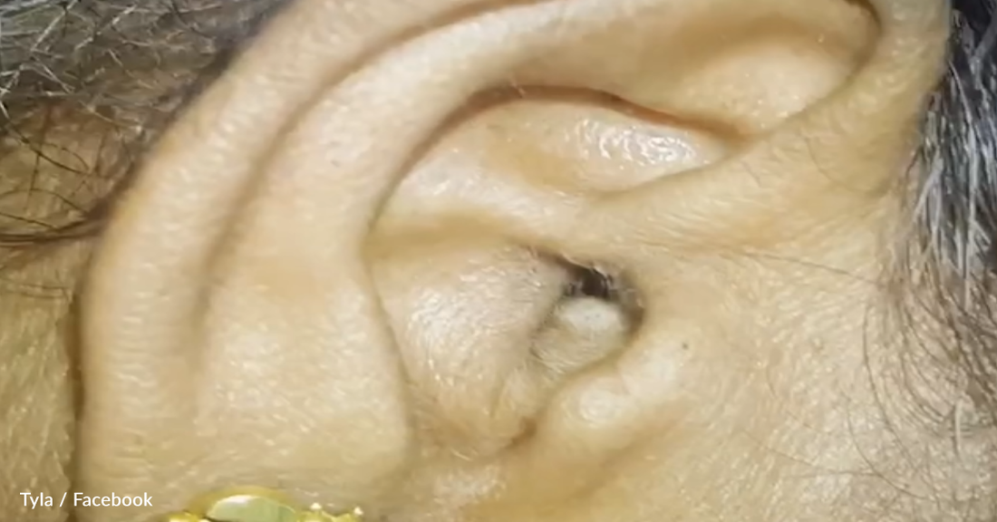 Video Shows Spider Setting Up Nest In Woman's Ear And People Can't Handle It