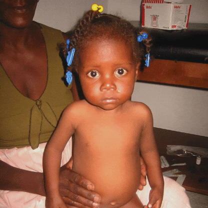 Donation - Super Nutrition For Malnourished Children